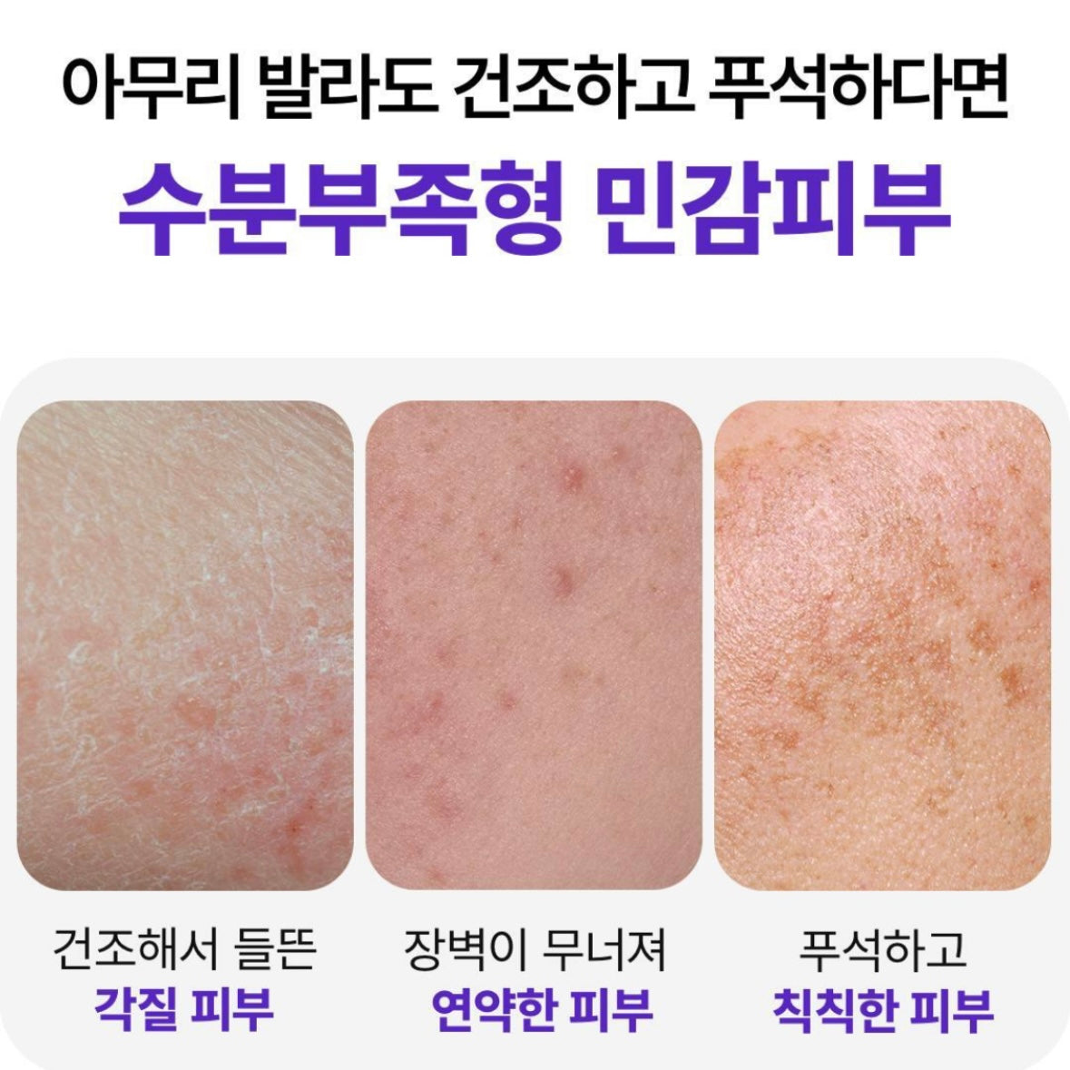 (1+1) Skin & lab 修復肌膚屏障保濕精華 (70ml + 70ml)