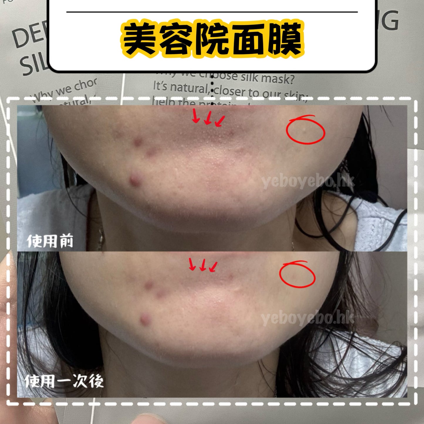 紐西蘭￼MC DERMA 皇牌超強補水鎖水抗敏膠原蠶絲面膜 (十片)