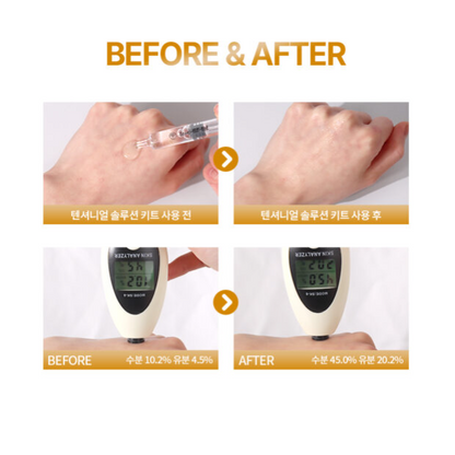韓國醫美品牌TOM-TIT-TOT Tensioneal Solution Kit 微針護膚套裝（一盒10次)