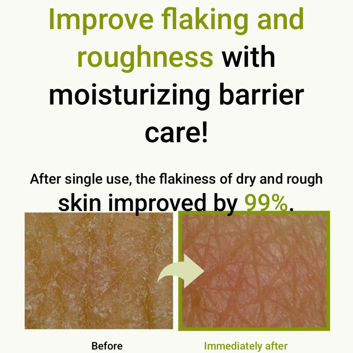 韓國皮膚科醫生推薦️!! ZEROID Intensive Cream 80ml (+50ml)