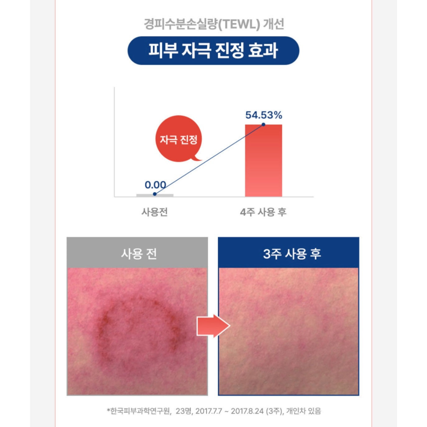 Benestem Human CBCM Cream 敏感肌必備⭐️高保濕修復霜  (50ml)
