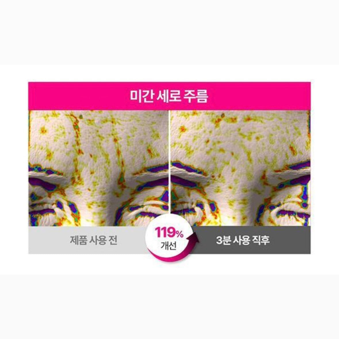 (1+1) ISOI Blemish Care Eye & Wrinkle Pad 緊緻眼周肌膚去細紋眼膜 (90片+90片)