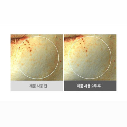 (1+1) ISOI Blemish Care Eye & Wrinkle Pad 緊緻眼周肌膚去細紋眼膜 (90片+90片)