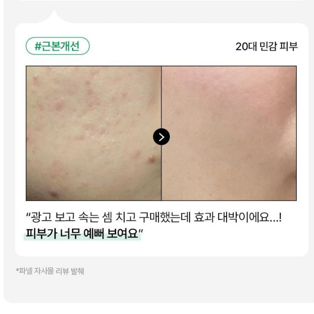 Parnell (1+1) 92積雪草強效舒緩精華液 (30ml) x2