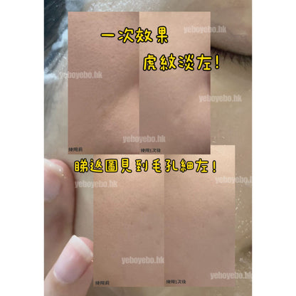 Elthy 素顏水晶針 (一套10片)