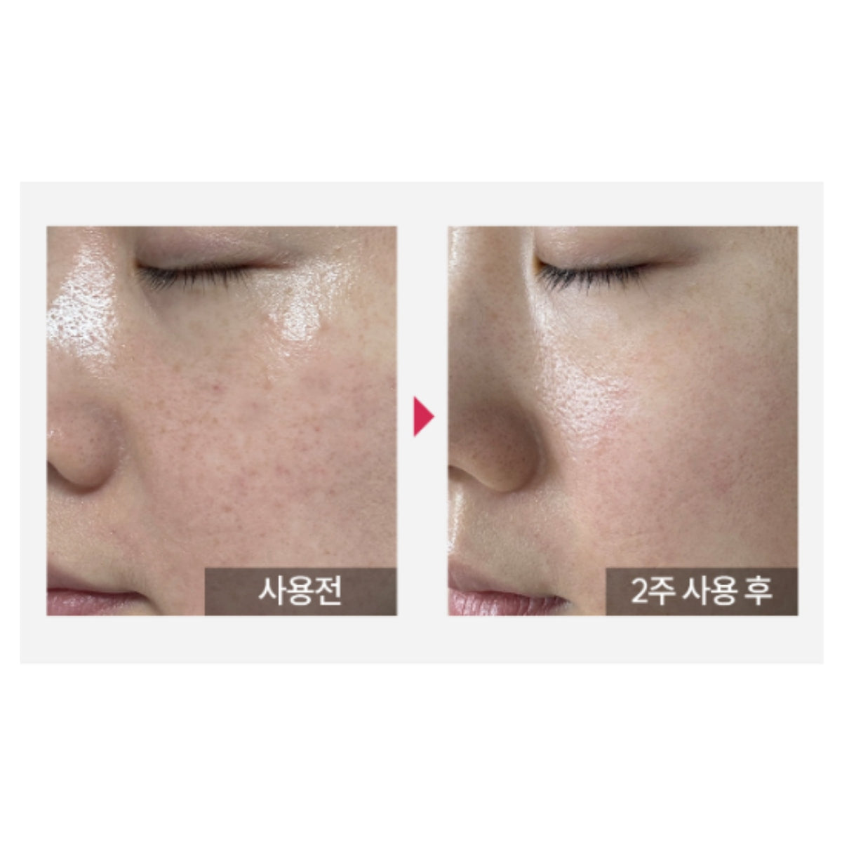 韓國知名皮膚科診所合作開發! Kopher Curepair Mela Cream (35ml)
